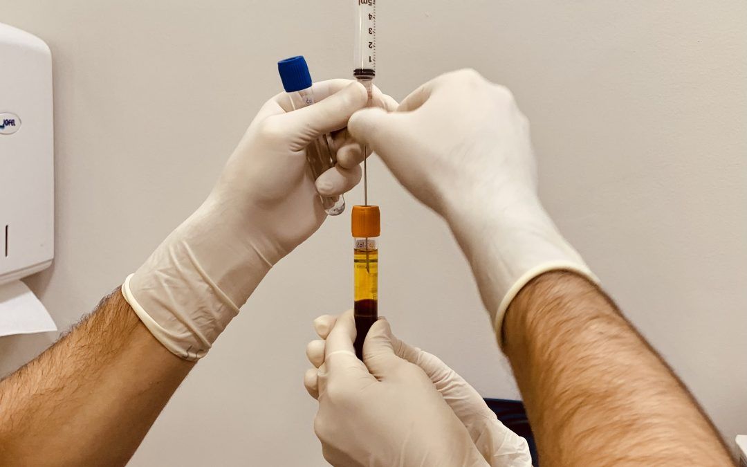 tratamiento de la Fascitis Plantar: uso ecoguiado de factores de crecimiento